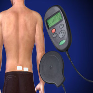 medtronic dorsal column stimulators