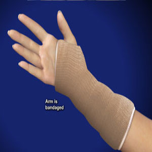 Colles Fracture Definiton – Broken Wrist