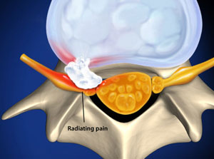 Spine And Tailbone Treatment